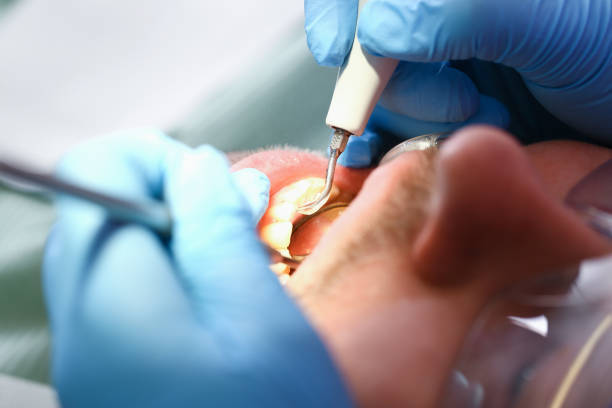 Best Emergency Treatment for Toothache in Slinger, WI