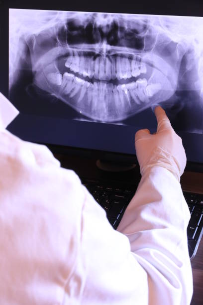 Best Emergency Tooth Extraction in Slinger, WI